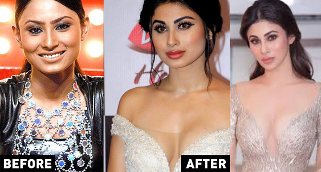 Bollywood actress plastic surgery - mouni roy