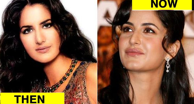 Bollywood actress plastic surgery - Katrina kaif plastic surgery